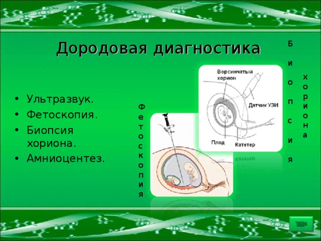 Дородовая диагностика Б и о п с и я х о р и о н а Ультразвук. Фетоскопия. Биопсия хориона. Амниоцентез. Ф е т о с к о п и я