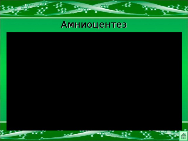 Амниоцентез