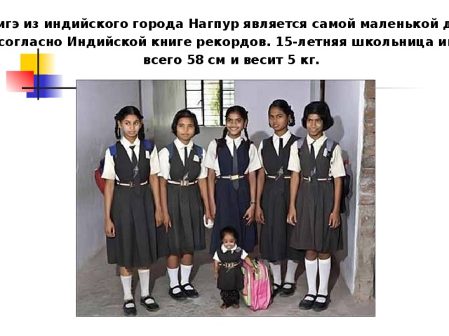 Карликовость Гигантизм 