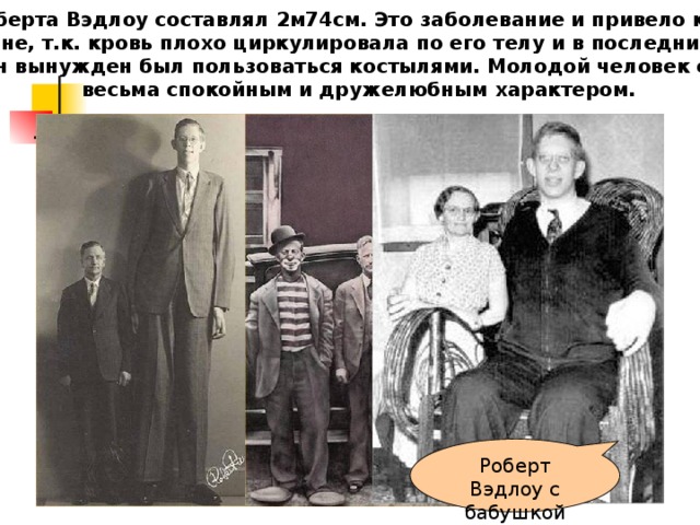 Самая маленькая пара Ли Танюн (107,5 см) и Чэнь Гуйлань (70см) из Китая – самые низкие супруги в мире. Три года они откладывали свою свадьбу из – за возражения своих семей. Но 1 октября 2007г в составе 30 других пар они совершили бракосочетание в городском парке. 