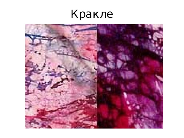 Кракле 