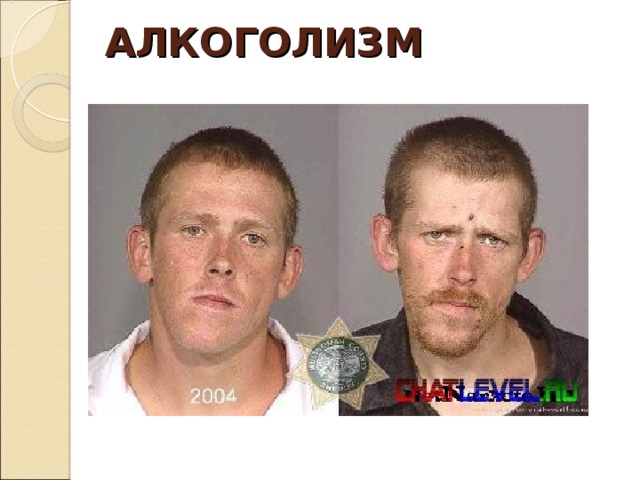 АЛКОГОЛИЗМ 
