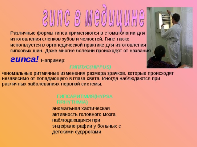 Различные формы гипса применяются в стоматологии для изготовления слепков зубов и челюстей. Гипс также используется в ортопедической практике для изготовления гипсовых шин. Даже многие болезни происходят от названия гипса! Например:    ГИППУС( HIPPUS) аномальные ритмичные изменения размера зрачков, которые происходят независимо от попадающего в глаза света. Иногда наблюдаются при различных заболеваниях нервной системы. ГИПСАРИТМИЯ( HYPSARRHYTHMIA)  аномальная хаотическая активность головного мозга, наблюдающаяся при энцефалографии у больных с детскими судорогами 