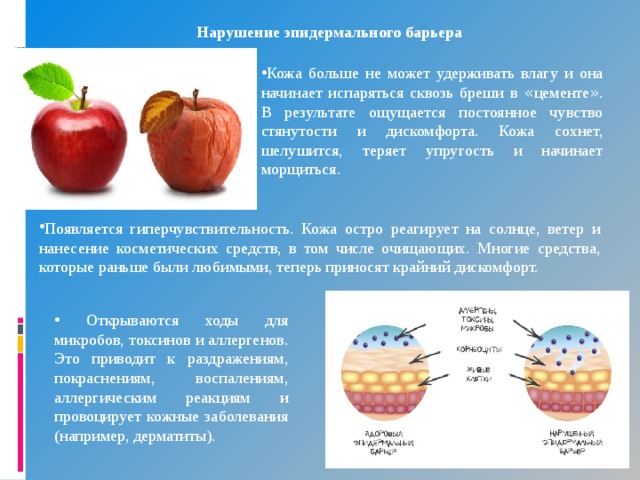 Нарушение эпидермального барьера Кожа больше не может удерживать влагу и она начинает испаряться сквозь бреши в « цементе » . В результате ощущается постоянное чувство стянутости и дискомфорта. Кожа сохнет, шелушится, теряет упругость и начинает морщиться. Появляется гиперчувствительность. Кожа остро реагирует на солнце, ветер и нанесение косметических средств, в том числе очищающих. Многие средства, которые раньше были любимыми, теперь приносят крайний дискомфорт.  Открываются ходы для микробов, токсинов и аллергенов. Это приводит к раздражениям, покраснениям, воспалениям, аллергическим реакциям и провоцирует кожные заболевания (например, дерматиты). 
