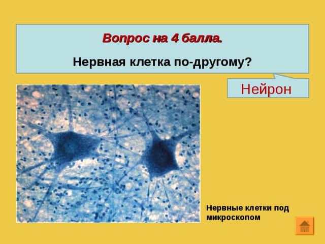 Вопрос на 4 балла.  Нервная клетка по-другому? Нейрон Нервные клетки под микроскопом 12 