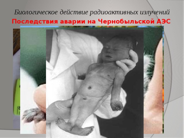 Биологическое действие радиоактивных излучений Последствия аварии на Чернобыльской АЭС 