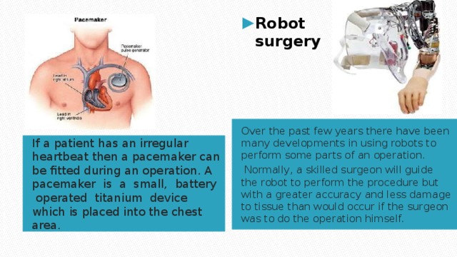   Robot  surgery Over the past few years there have been many developments in using robots to perform some parts of an operation.  Normally, a skilled surgeon will guide the robot to perform the procedure but with a greater accuracy and less damage to tissue than would occur if the surgeon was to do the operation himself. If a patient has an irregular heartbeat then a pacemaker can be fitted during an operation. A pacemaker is a small, battery operated titanium device which is placed into the chest area. 