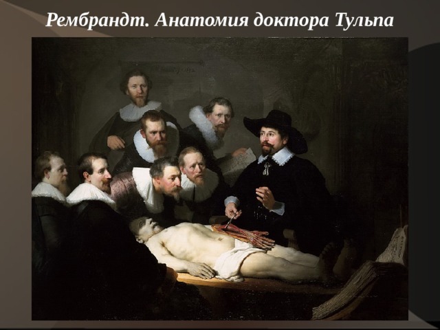 Рембрандт. Анатомия доктора Тульпа    