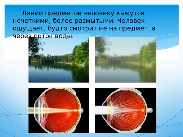  Линии предметов человеку кажутся нечеткими, более размытыми. Человек ощущает, будто смотрит не на предмет, а через поток воды. 