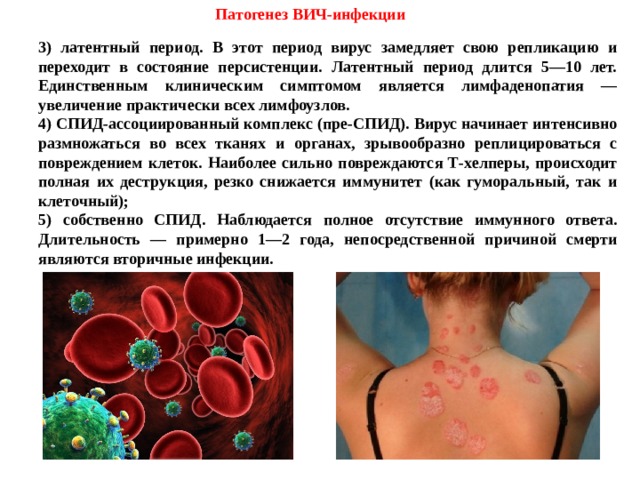Патогенез ВИЧ-инфекции 3) латентный период. В этот период вирус замедляет свою репликацию и переходит в состояние персистенции. Латентный период длится 5—10 лет. Единственным клиническим симптомом является лимфаденопатия — увеличение практически всех лимфоузлов. 4) СПИД-ассоциированный комплекс (пре-СПИД). Вирус начинает интенсивно размножаться во всех тканях и органах, зрывообразно реплицироваться с повреждением клеток. Наиболее сильно повреждаются Т-хелперы, происходит полная их деструкция, резко снижается иммунитет (как гуморальный, так и клеточный); 5) собственно СПИД. Наблюдается полное отсутствие иммунного ответа. Длительность — примерно 1—2 года, непосредственной причиной смерти являются вторичные инфекции. 
