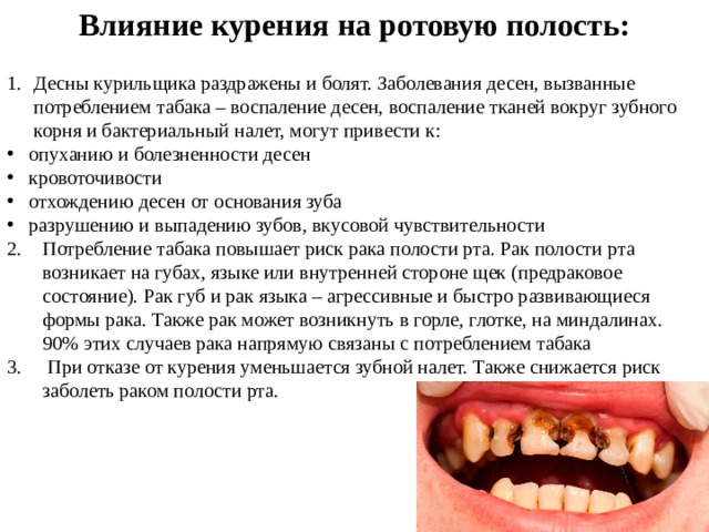 Влияние курения на ротовую полость: Десны курильщика раздражены и болят. Заболевания десен, вызванные потреблением табака – воспаление десен, воспаление тканей вокруг зубного корня и бактериальный налет, могут привести к:   опуханию и болезненности десен  кровоточивости  отхождению десен от основания зуба  разрушению и выпадению зубов, вкусовой чувствительности Потребление табака повышает риск рака полости рта. Рак полости рта возникает на губах, языке или внутренней стороне щек (предраковое состояние). Рак губ и рак языка – агрессивные и быстро развивающиеся формы рака. Также рак может возникнуть в горле, глотке, на миндалинах. 90% этих случаев рака напрямую связаны с потреблением табака  При отказе от курения уменьшается зубной налет. Также снижается риск заболеть раком полости рта. 