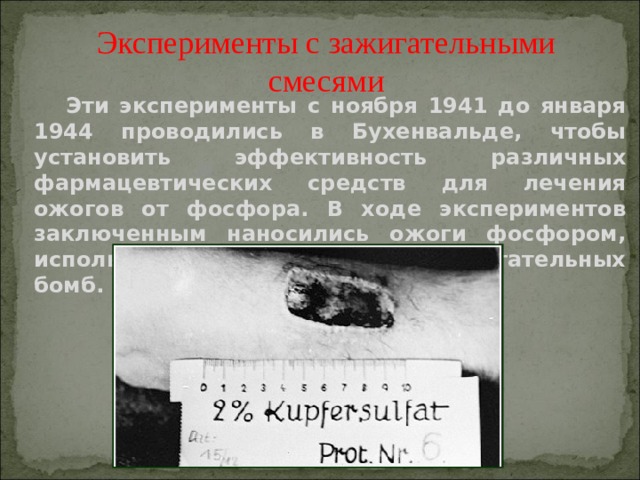 Эксперименты с зажигательными смесями  Эти эксперименты с ноября 1941 до января 1944 проводились в Бухенвальде, чтобы установить эффективность различных фармацевтических средств для лечения ожогов от фосфора. В ходе экспериментов заключенным наносились ожоги фосфором, используемым для снаряжения зажигательных бомб. 