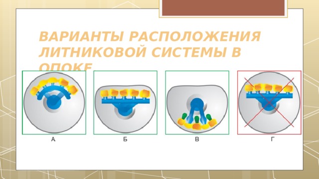 ВАРИАНТЫ РАСПОЛОЖЕНИЯ ЛИТНИКОВОЙ СИСТЕМЫ В ОПОКЕ. 