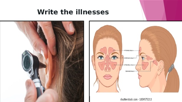 Write the illnesses 