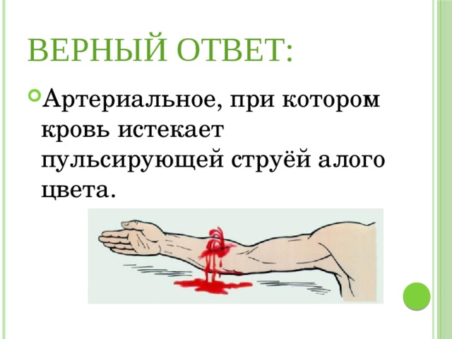 Верный ответ: Артериальное, при котором кровь истекает пульсирующей струёй алого цвета. 