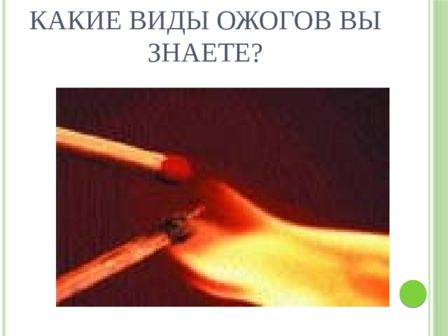 Какие виды ожогов вы знаете? 