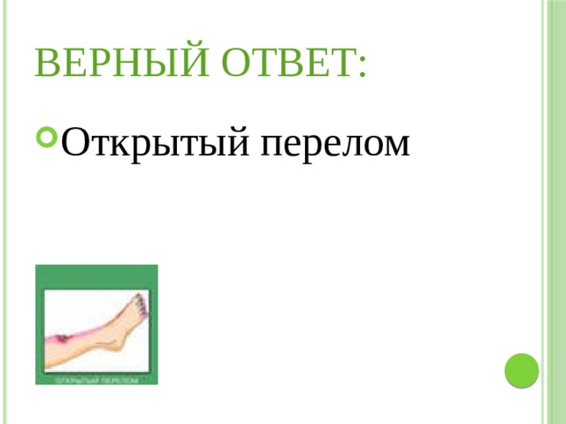 Верный ответ: Открытый перелом 