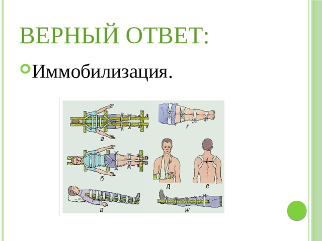 Верный ответ: Иммобилизация. 