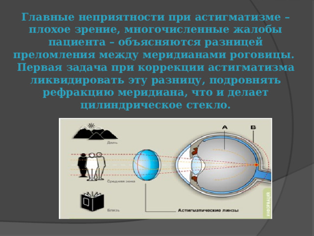 Главные неприятности при астигматизме – плохое зрение, многочисленные жалобы пациента – объясняются разницей преломления между меридианами роговицы.  Первая задача при коррекции астигматизма ликвидировать эту разницу, подровнять рефракцию меридиана, что и делает цилиндрическое стекло.   