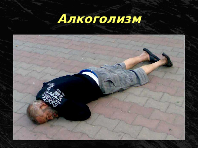 Алкоголизм 