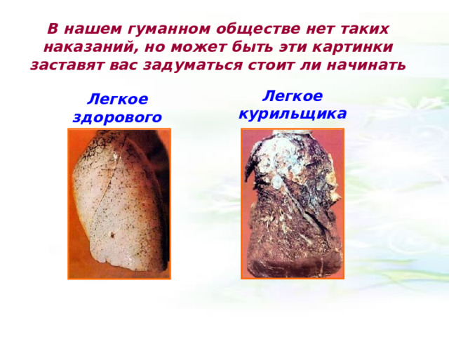 В нашем гуманном обществе нет таких наказаний, но может быть эти картинки заставят вас задуматься стоит ли начинать Легкое курильщика Легкое здорового человека 