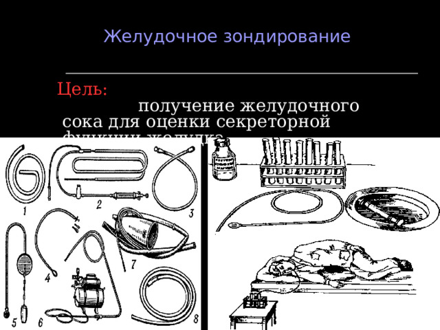     Желудочное зондирование   Цель: получение желудочного сока для оценки секреторной функции желудка.    