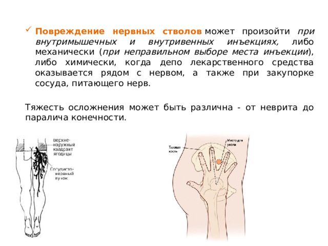 Повреждение нервных стволов  может произойти при внутримышечных и внутривенных инъекциях, либо механически ( при неправильном выборе места инъекции ), либо химически, когда депо лекарственного средства оказывается рядом с нервом, а также при закупорке сосуда, питающего нерв. Тяжесть осложнения может быть различна - от неврита до паралича конечности.  