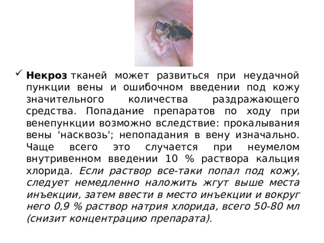 Некроз  тканей может развиться при неудачной пункции вены и ошибочном введении под кожу значительного количества раздражающего средства. Попадание препаратов по ходу при венепункции возможно вследствие: прокалывания вены 'насквозь'; непопадания в вену изначально. Чаще всего это случается при неумелом внутривенном введении 10 % раствора кальция хлорида. Если раствор все-таки попал под кожу, следует немедленно наложить жгут выше места инъекции, затем ввести в место инъекции и вокруг него 0,9 % раствор натрия хлорида, всего 50-80 мл (снизит концентрацию препарата).  