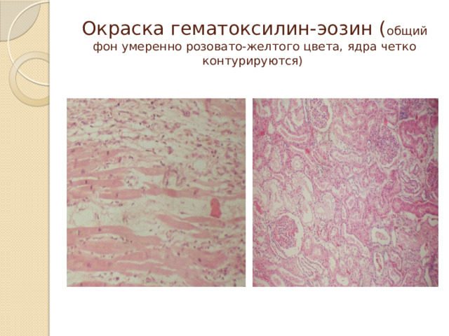 Окраска гематоксилин-эозин ( общий фон умеренно розовато-желтого цвета, ядра четко контурируются) 