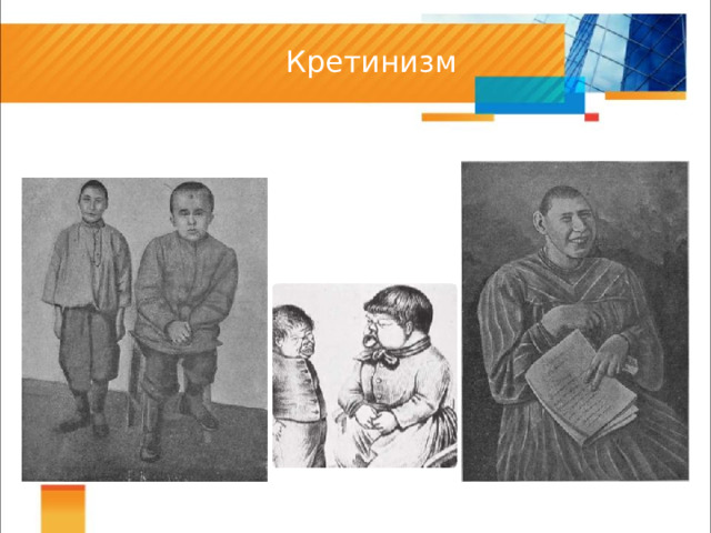 Кретинизм 