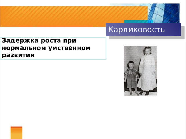 Карликовость Задержка роста при нормальном умственном развитии 