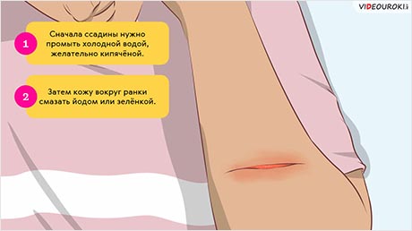 Если больно. Первая помощь при травмах